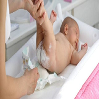 Dermatitis en bebés por pañal