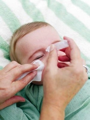 Cómo limpiar las lagañas de un Bebé con cuidado