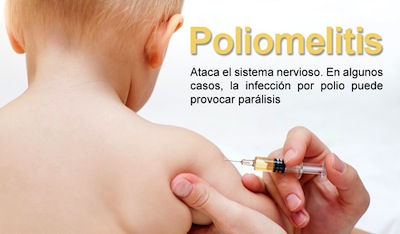 La Poliomielitis en los Niños, síntomas y tratamiento